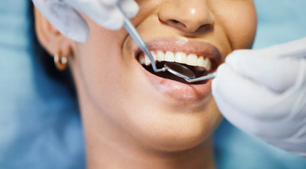 Best Emergency Dentist for Lost Fillings or Crowns in Williamsport, PA